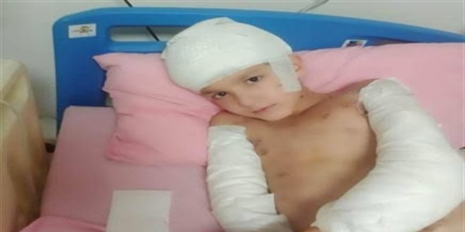 Keçiören'de Başıboş Köpek Saldırısı Davası: Belediye Personeline Hapis Talebi